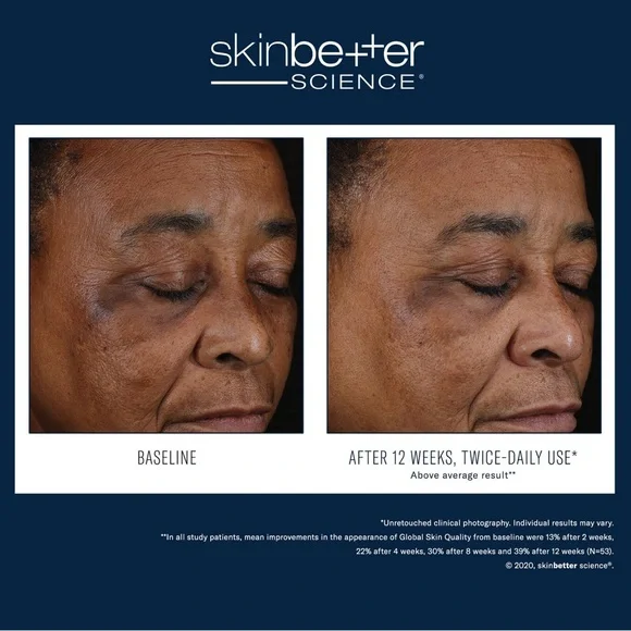 SkinBetter - Mystro - Picture 2 of 3